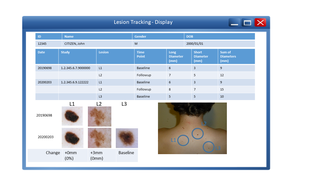 Potential Lesion Tracking Reporting Window Display