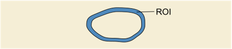 Example of ROI with contours exclusively added