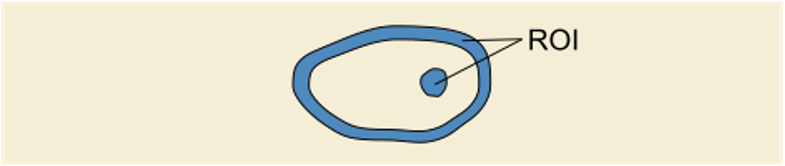 Example of ROI with disjoint parts
